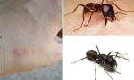 Mravence kousnutí a jeho důsledky